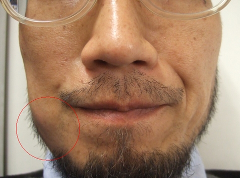 jedi_090812_cheek.jpg