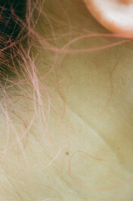 フォーカスしたのは“ほくろ”。『agnosia』と題したCho Ongoの写真展は、音声メディアやZINEの発表もあります。
